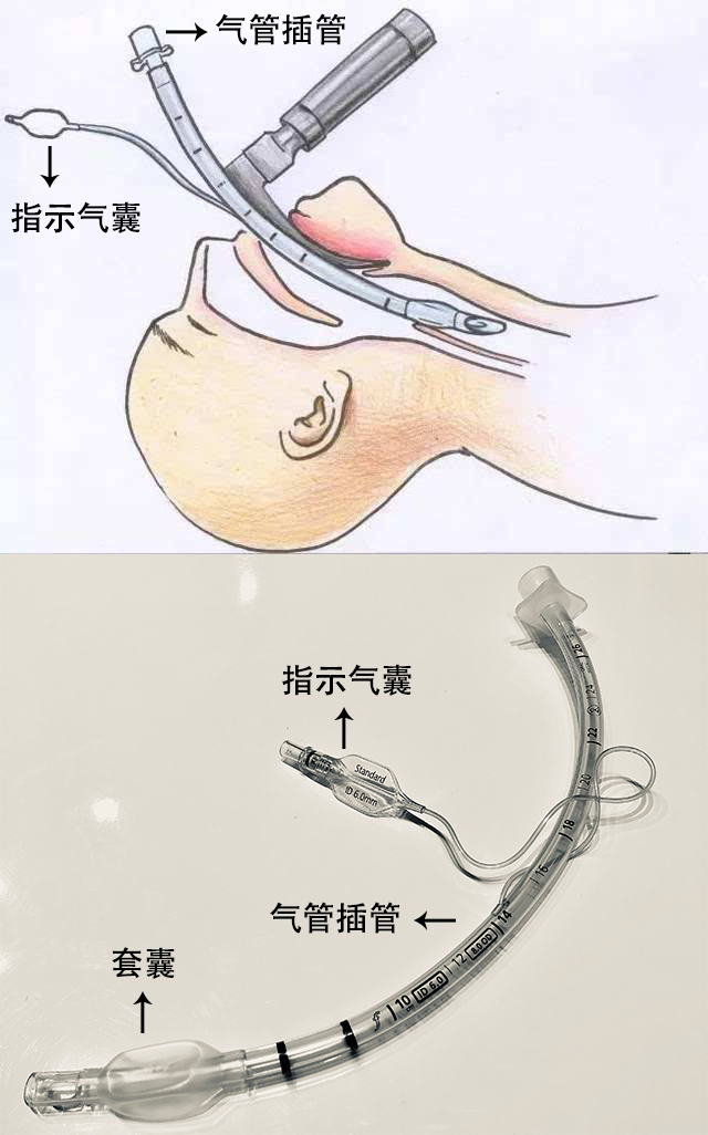 贊?。?！250萬(wàn)指示氣囊，客戶100%滿意！